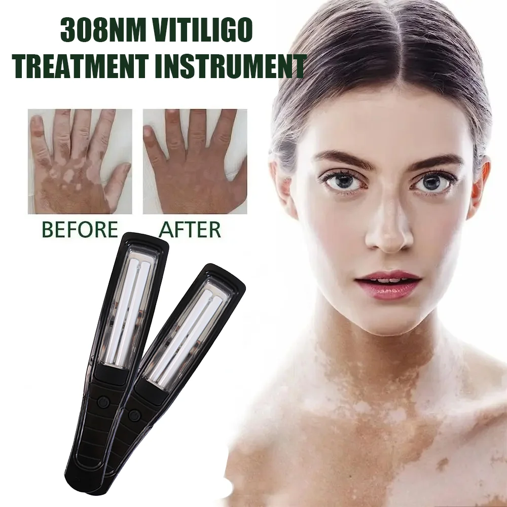 

311NM UVB Phototherapy Lamp Device for Vitiligo Treatment UV NarrowBand Ultraviolet Light Therapy Psoriasis Spots Eczema