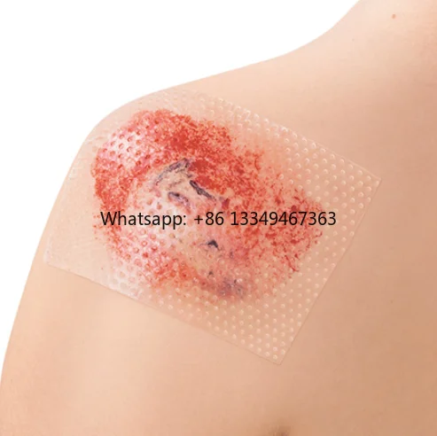 Silicone Sheet Single Sided Silicone to the Skin Surface 7.5*10cm