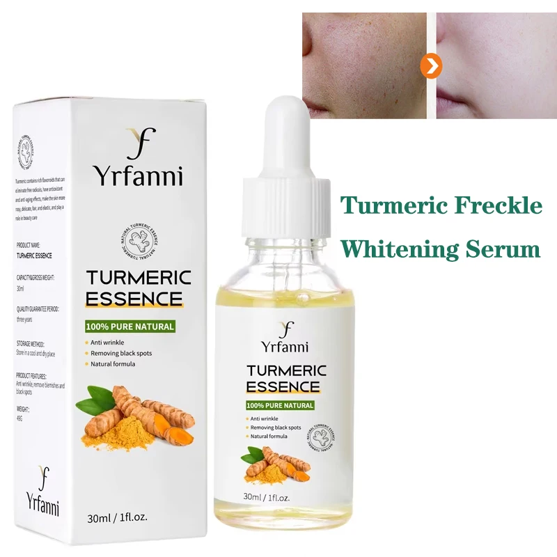

Turmeric Freckle Whitening Serum Bright Freckles Removal Essential Oil Remove Melasma Melanin Dark Spots Acne Marks Face Skin