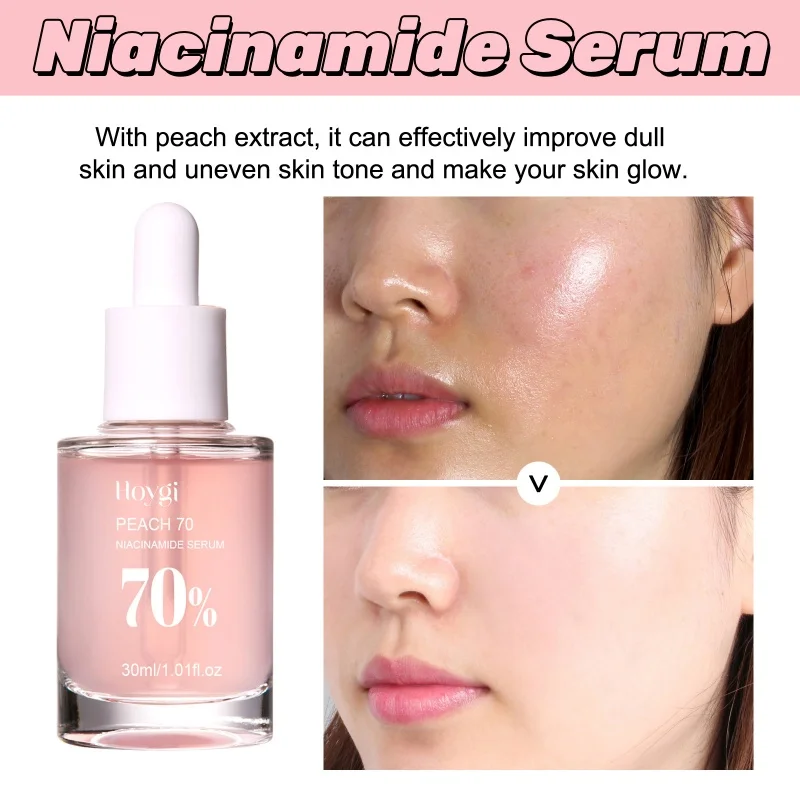 

Niacinamide Serum Melanin Removal Fade Melasma Dark Spots Corrector Shrink Pores Hyaluronic Acid Moisturizing Korea Skin Care