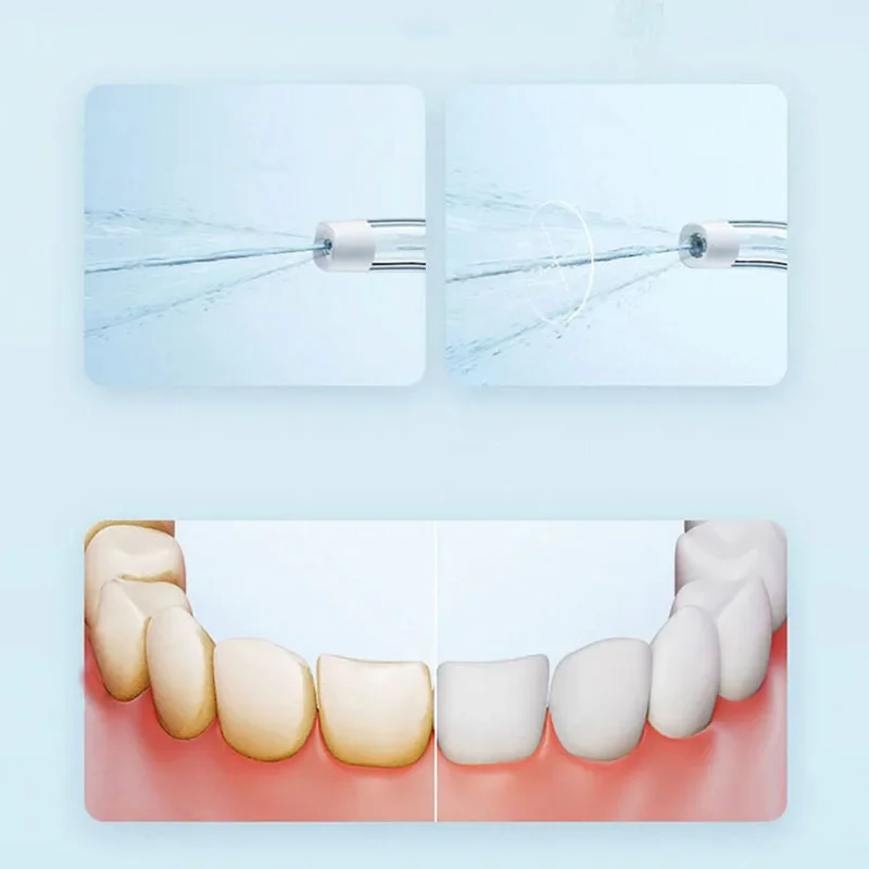 XIAOMI Oral Irrigator F300 Portable Dental Water Jet Water Flosser Teeth Whitening Bucal Tooth Cleaner Water Pulse IPX7 Original