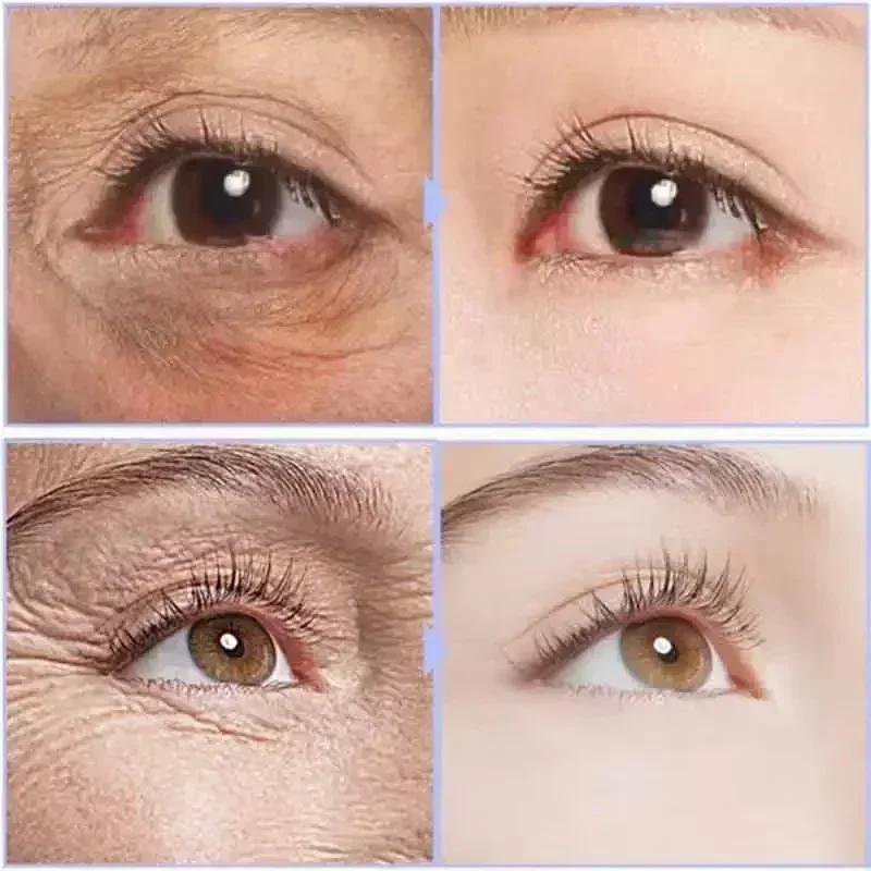 Instant Oogcrème Voor Anti Aging Donkere Kringen Zakken Wallen Geweldig Onder De Ogen Huidverstrakking Eye Lift Vetkorrels Remover Zorg