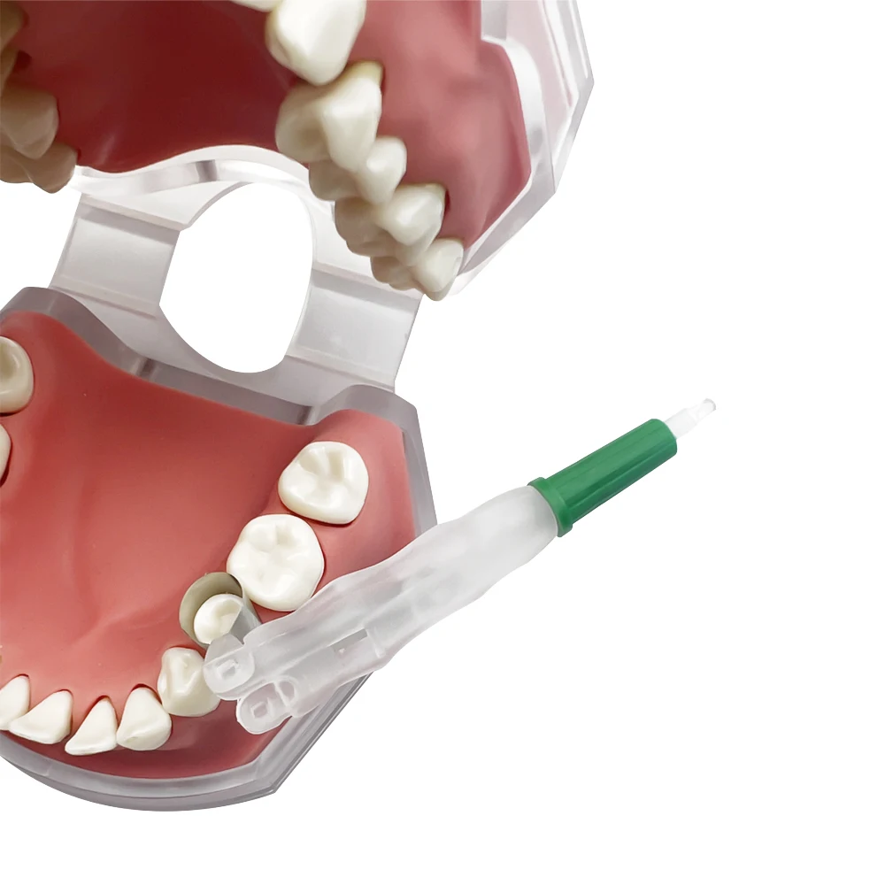 Dental Pro Matrix Bands For Teeth Filling Pre Formed Sectional Matrix Bands Hold Adjust Pre Formed 4.5/6.0MM Ring System Tool