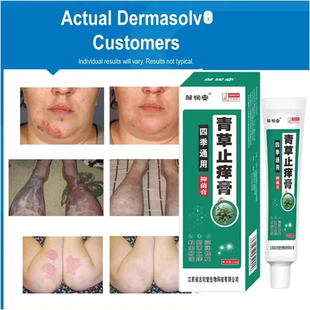 Herbal Antibacterial Cream Psoriasis Cream Itching Relief Eczema Rash Urticaria Scaling Treatment