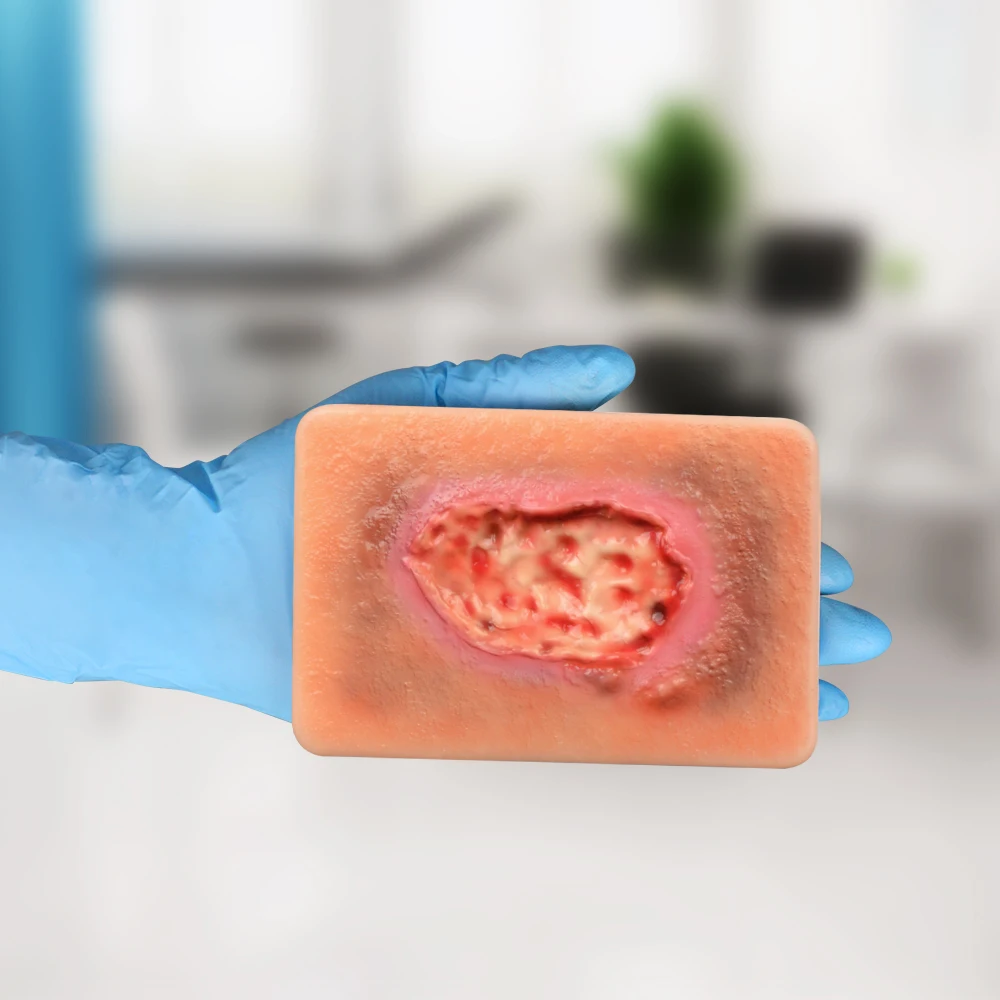3 Types Of Necrotic Tissue Model Pocket Wound Card For Wound Care Education In TCCC/EMT/PHEC Courses Medical Science Product