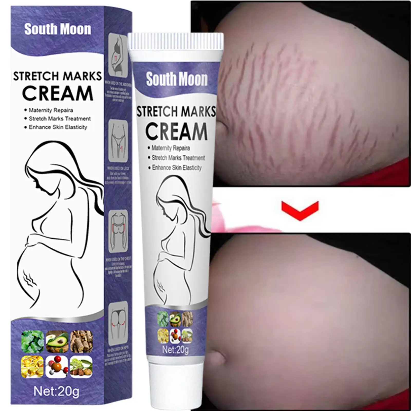 

Remove Pregnancy Scars Acne Cream Stretch Marks Treatment Maternity Repair Anti-Aging Anti-Winkles Firming Body Creams