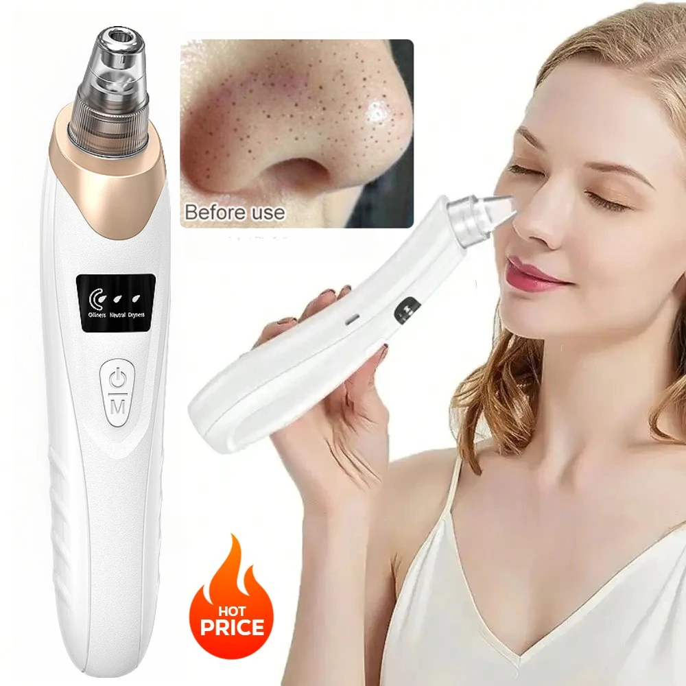 Dissolvant électrique de peau morte et épurateur facial, Machine de nettoyage du visage à aspiration à 3 niveaux pour un nettoyage en profondeur des pores