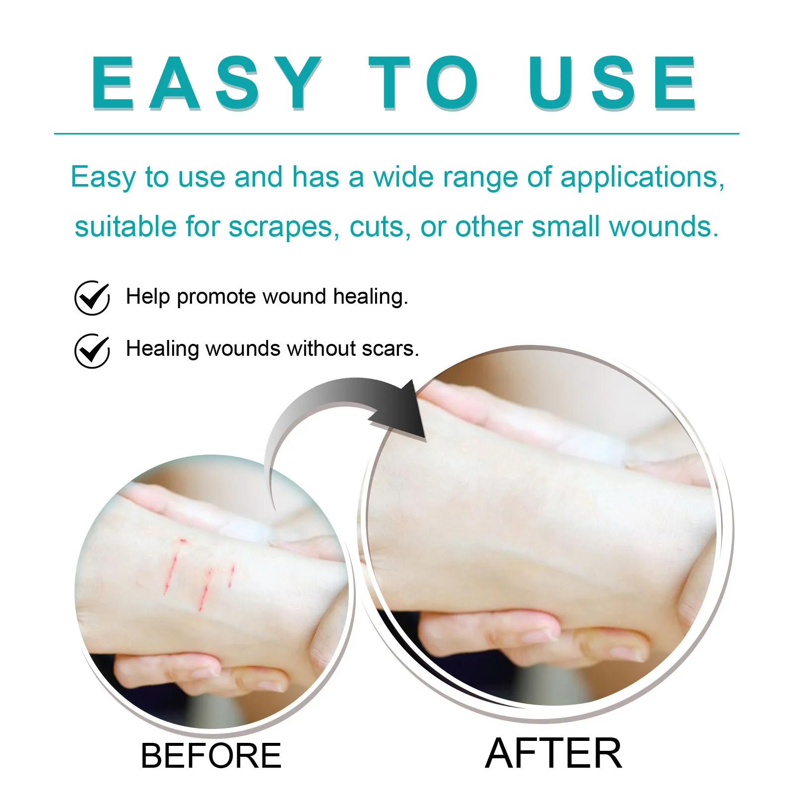 2024 New Liquid Bandage Spray Liquid Suture Wound Wound Glue Scar Reduction Scar Isolation 30ml Best Gifts For Female