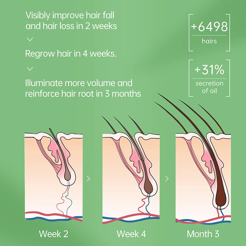 Purc-ConsumerおよびThrehybヘアケアセラム,頭皮トリートメント製品,オイル,増粘,縮れた髪