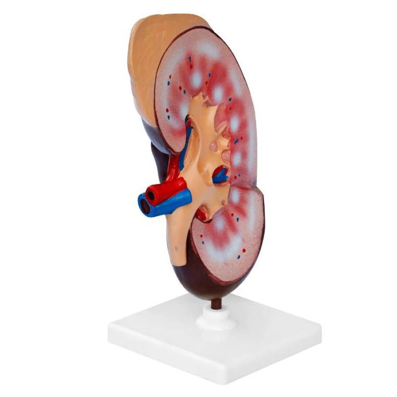 

Human Healthy Kidney Anatomy Model Medical Science Teaching Resources Dropshipping