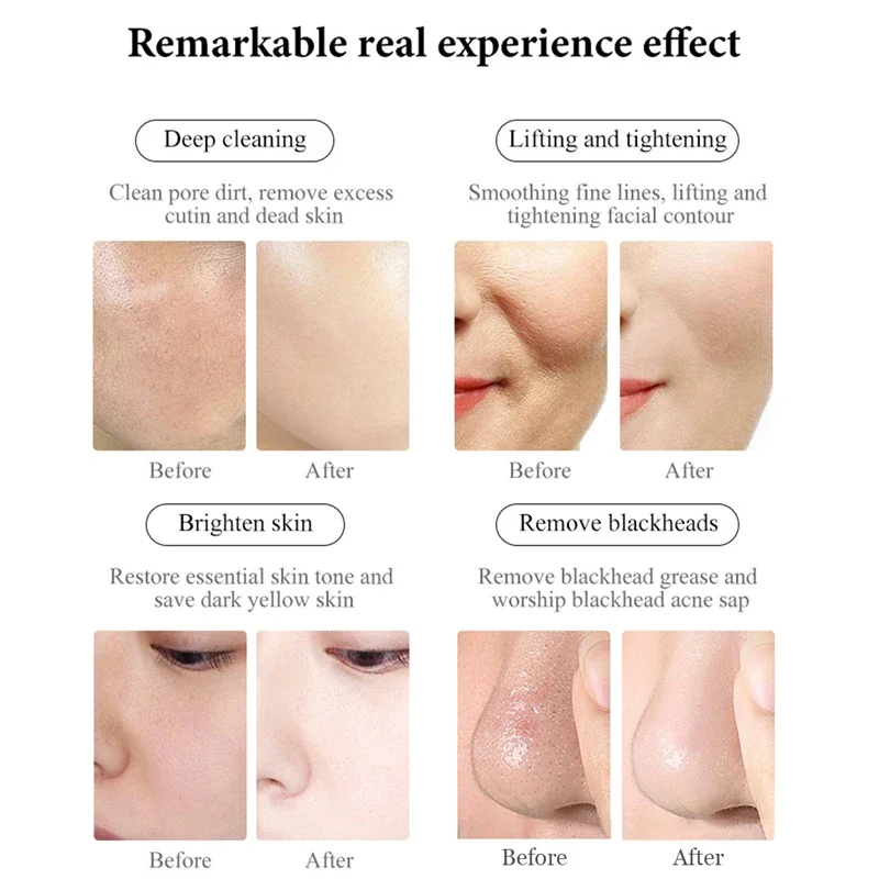 超音波美容機器 超音波フェイスリフティング アイマッサージ美容器 3 IN 1 スキンケア 毛穴洗浄 フェイシャルSPAマッサージャー