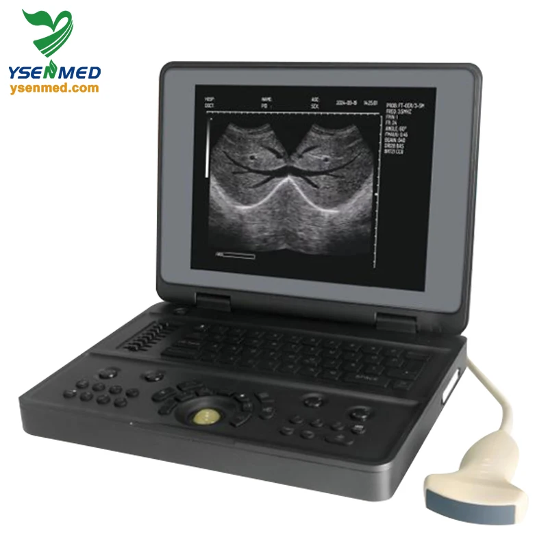 YSENMED YSB3000W Full Digital Ultrasound Imaging System Notebook Style Black And White Ultrasound Scanner