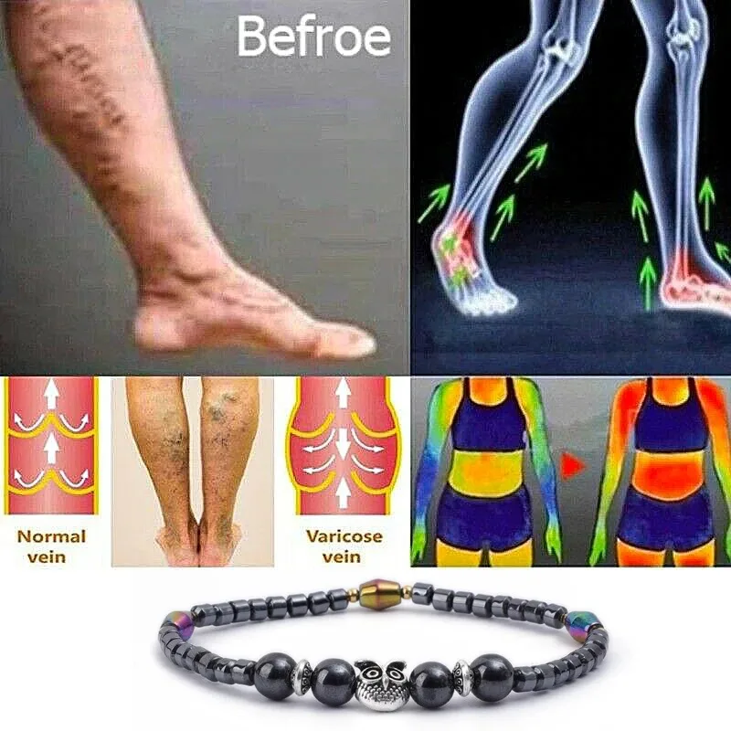 Thumbnail 2 - #8 Best Anklets to Buy In 2026