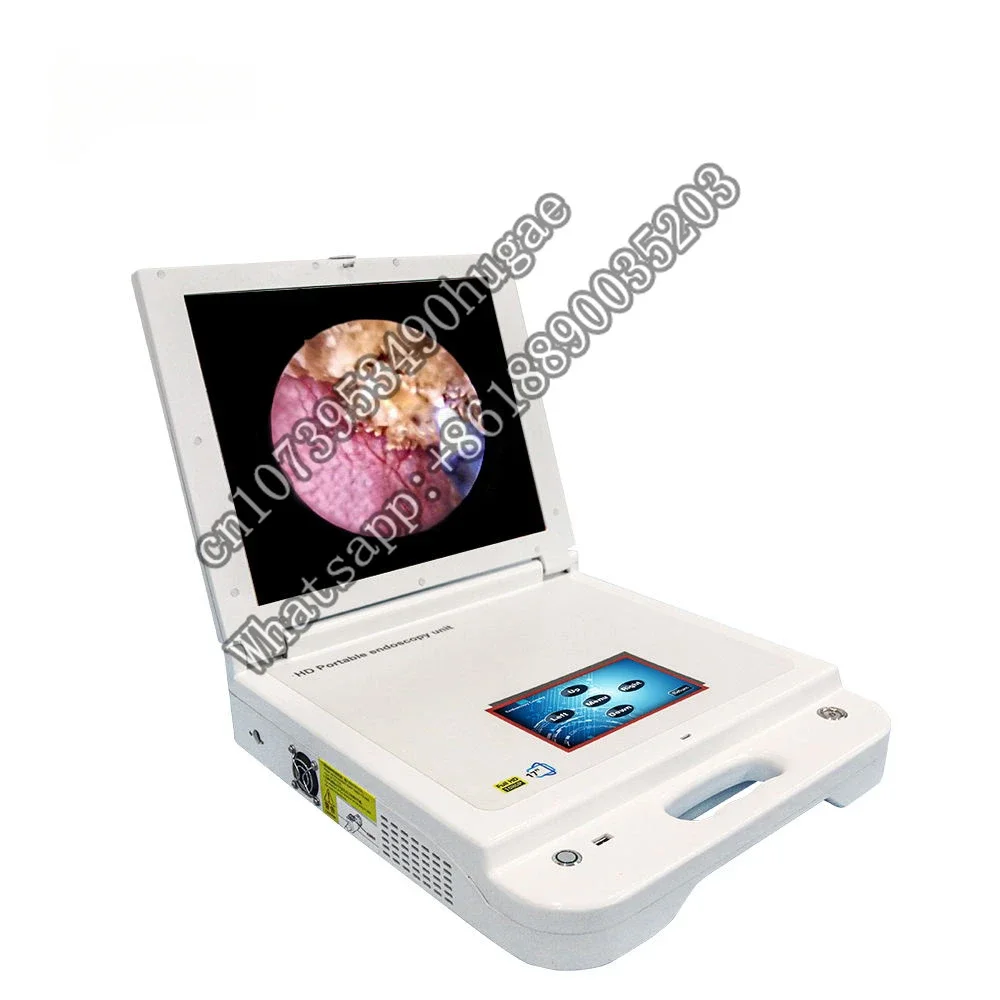 digital Endoscope hd vagina portable and  kidney stones