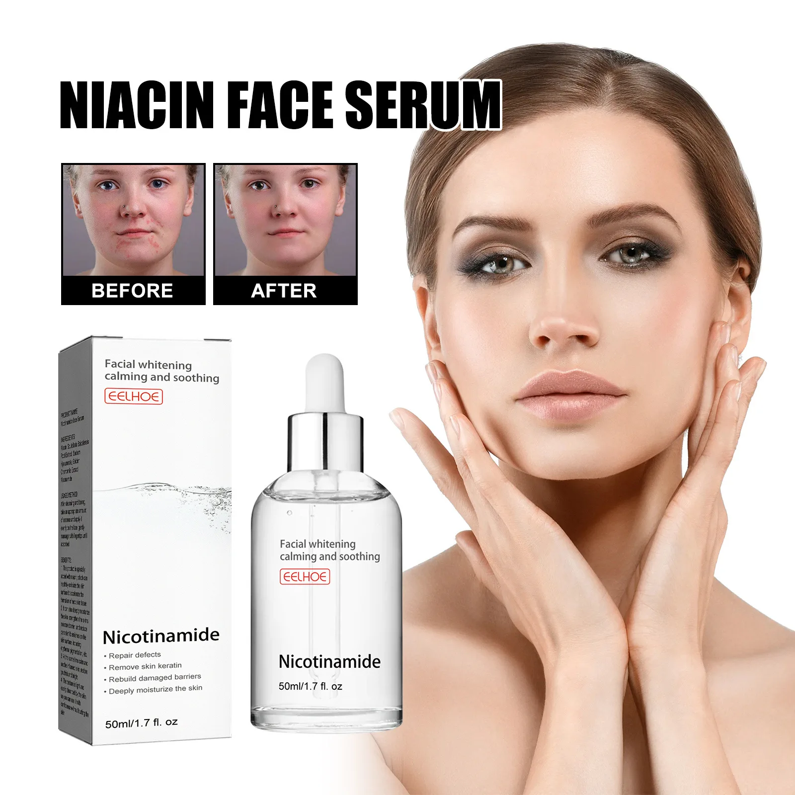 Nicotinic Acid Facial Essence Attenuates Acne Marks Moisturizes Pores Shrinks and Whitens Skin Essence