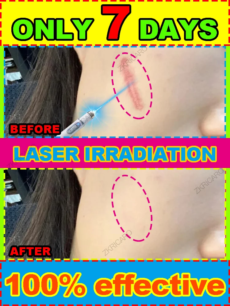 

The latest laser repair technology, suitable for various difficult to remove severe scars, solve all your scar problems