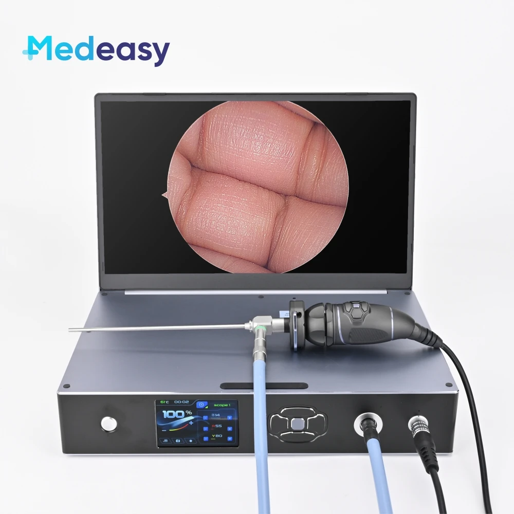 3 in 1 1080P 60Fps Full HD Endoscope Camera Unit With 15.6 Inch Medical Screen and 100W Led Cold Light Source