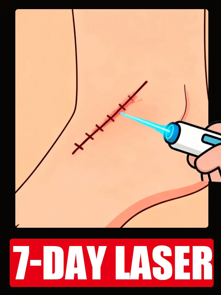 

Ручка с синим светом решает шрам, бестселлер в Азии.