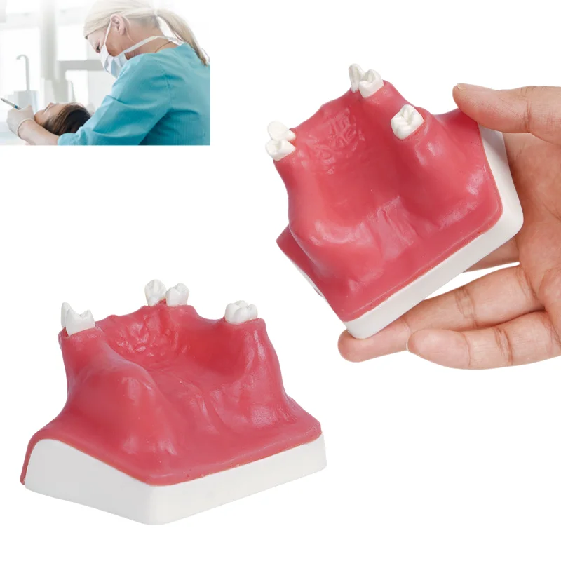 

Maxillary Sinus Lift Dental Implant Model Practice Model for Oral Surgery Teaching Doctor-Patient Communication Demonstration