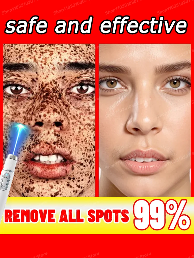 

Repair of facial dark spots