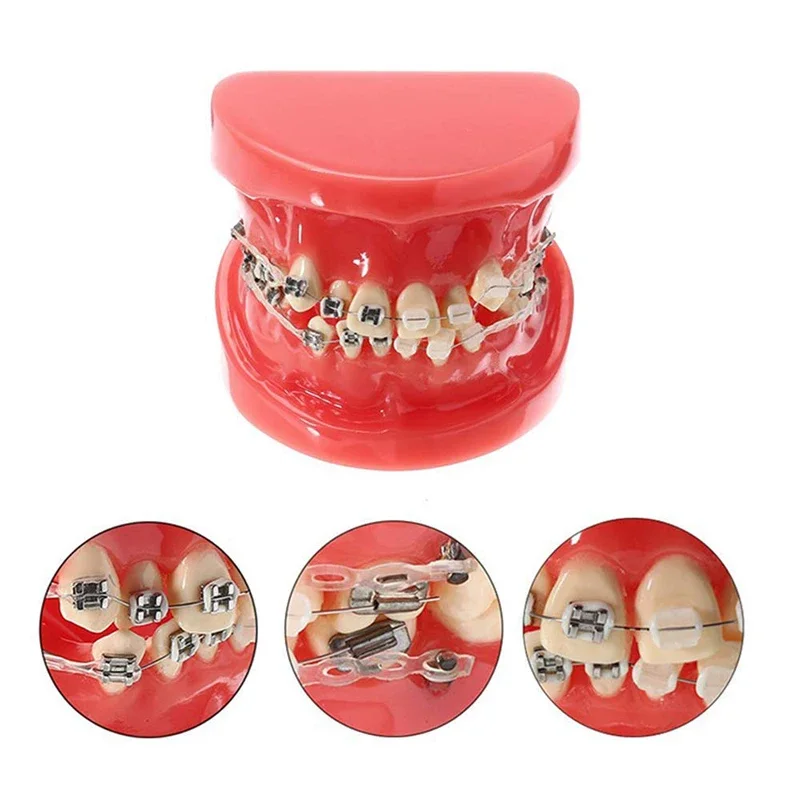 Dentist Orthodontic Treatment Model With Ceramic Metal Bracket Resin Orthodontic Teeth Model