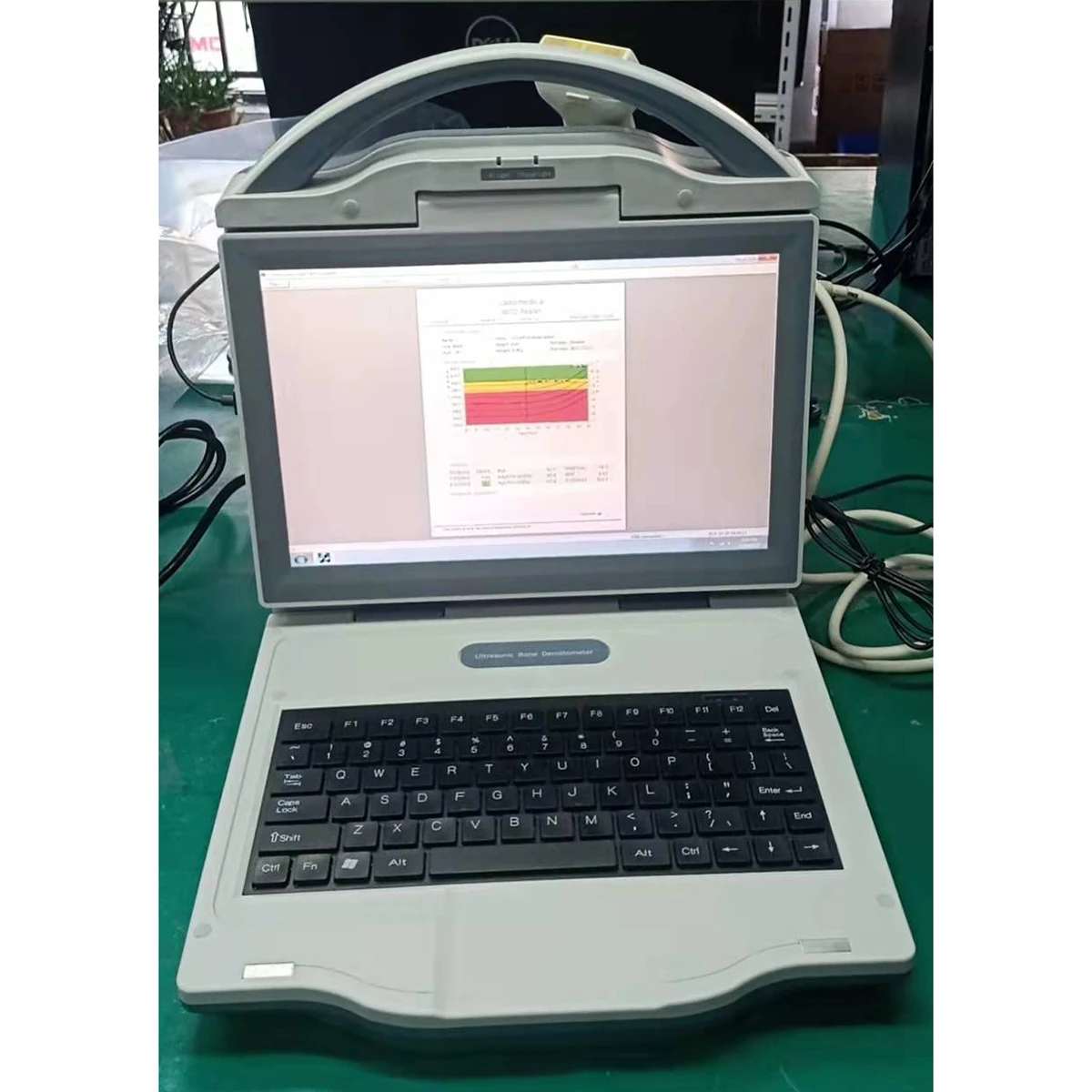 Medical Diagnostic Ultrasonic Bone Density Scanner Ultrasound Bone Densitometer