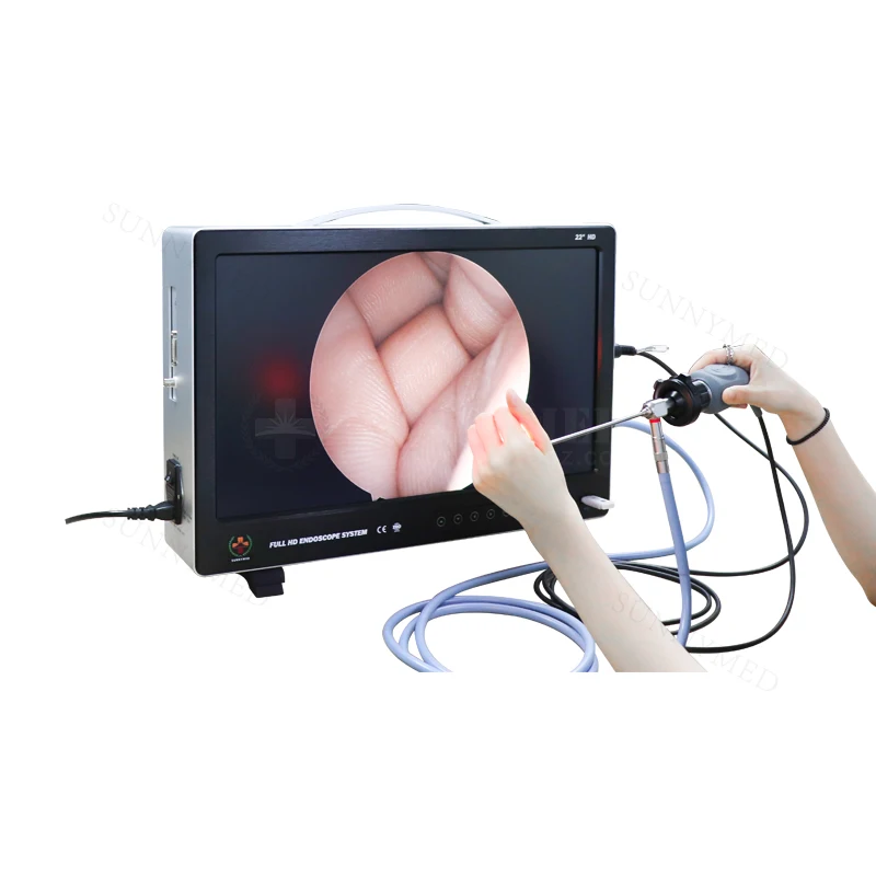 

portable hd endoscope camera system unit urology endoscope cystoscopy with rigid hysteroscopy endoscope