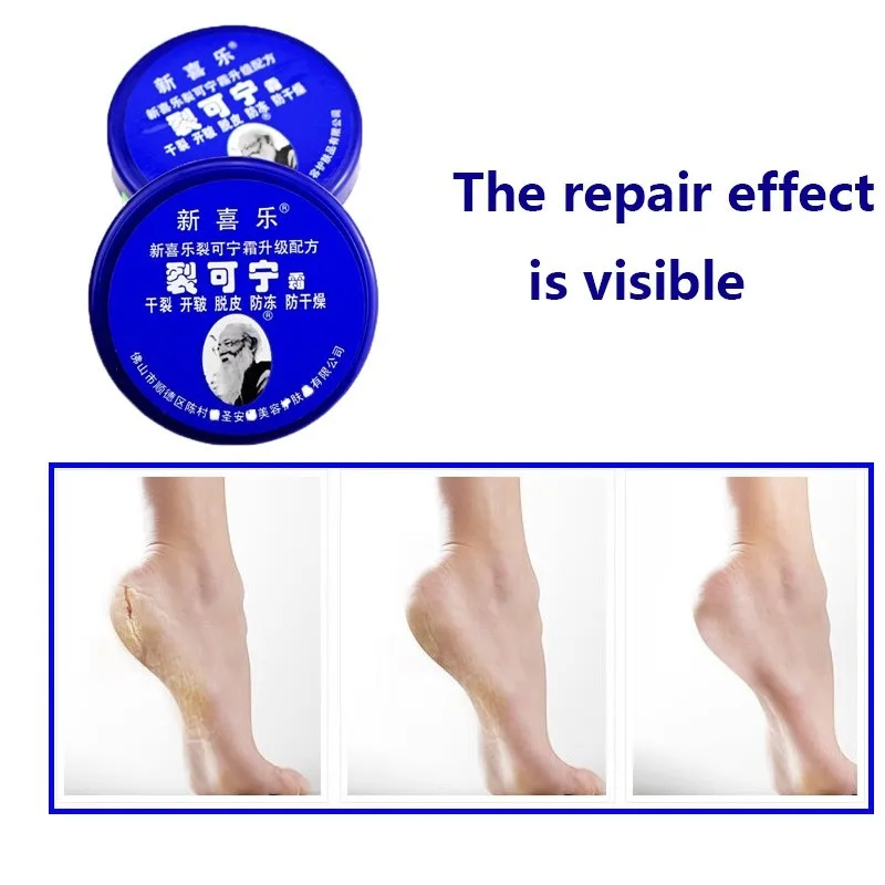 Size Traditional Chinese Upgrade Oil Anti-Drying Crack Foot Cream Heel Cracked Repair Cream Removal Dead Skin Hand Feet Care