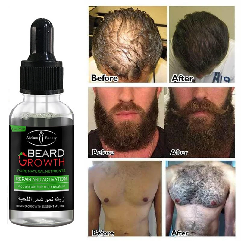 Homens barba óleo essencial soro barba axilar peito crescimento do cabelo rápido realçador tratamento alopecia mais grosso cuidados com o cabelo 30ml