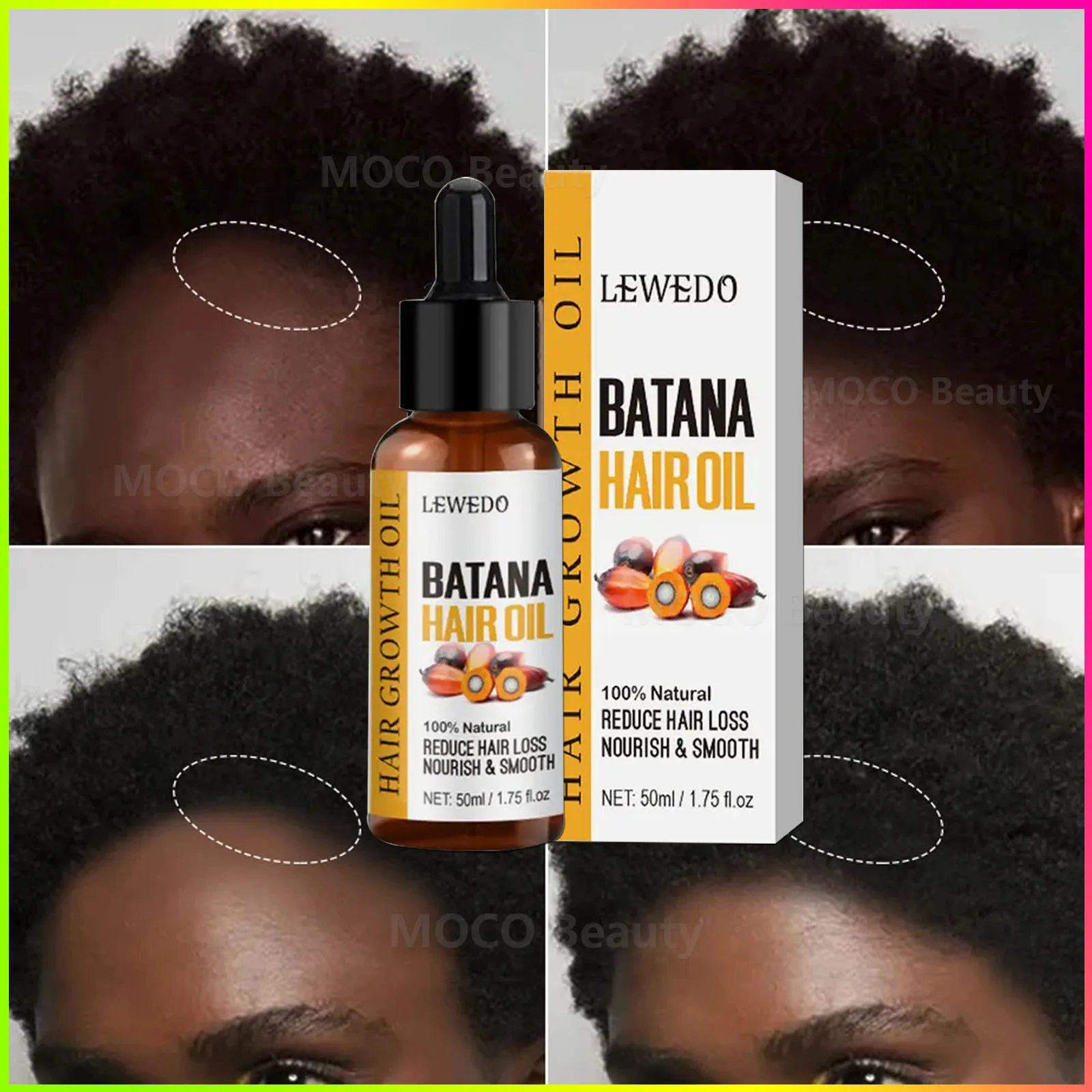 Batana Oil Hair Growth Products Fast Growth Batana Essence Oil Traction Alopecia Anti Hair Loss Baldness Treatment For Men Women