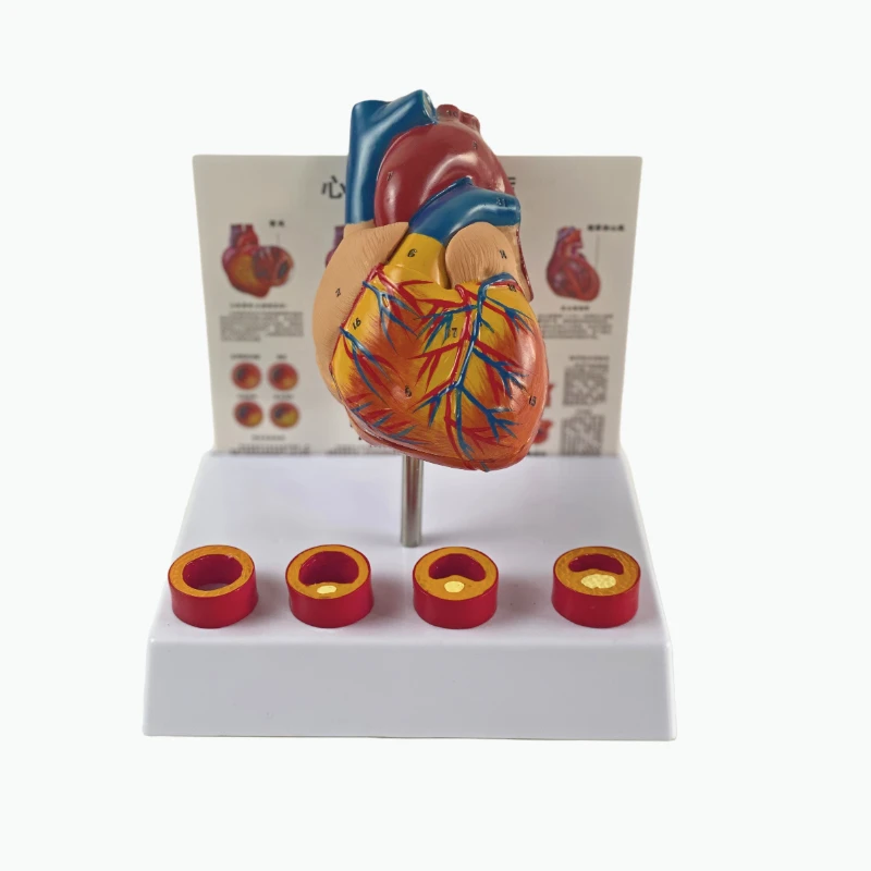 

Removable Anatomical Human Life Size Heart Medical Cardiovascular Anatomy Thrombotic Vascular Model 18x14x23cm