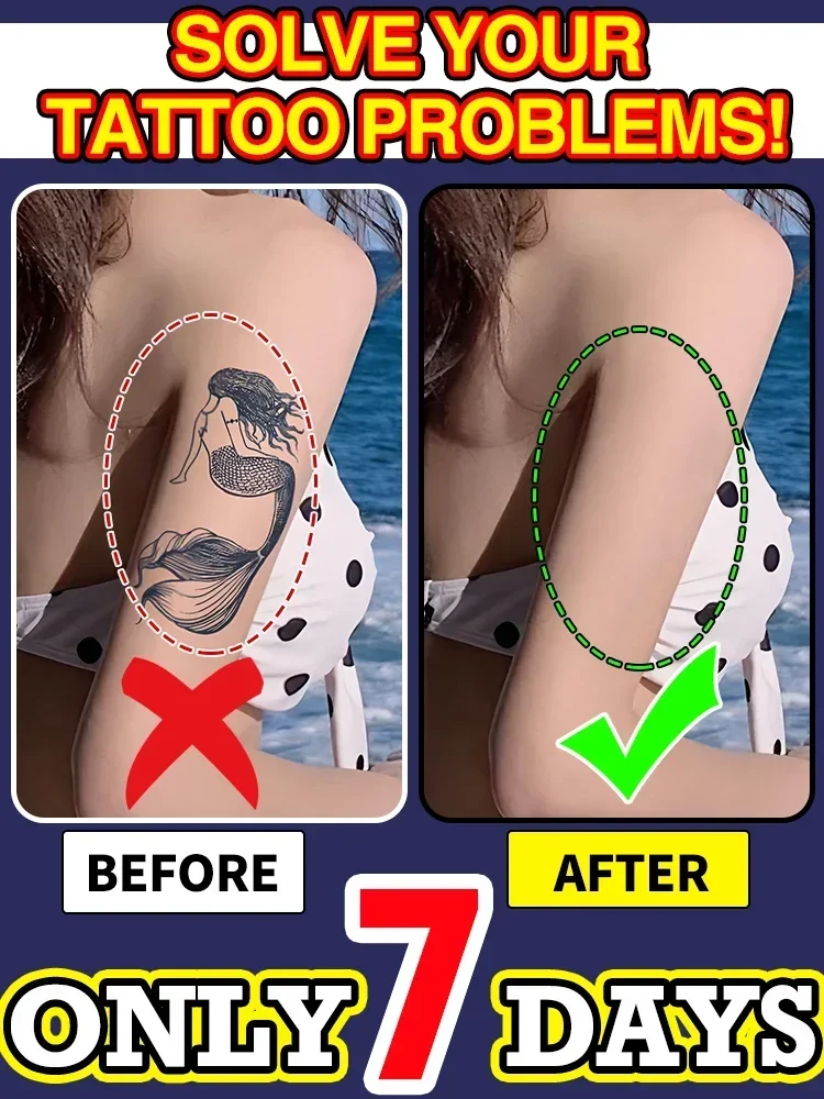 Huile Essentielle Pour DéTatouage, AdaptéE Aux Tatouages Grands Et Petits, éLimine Efficacement Les Tatouages Permanents