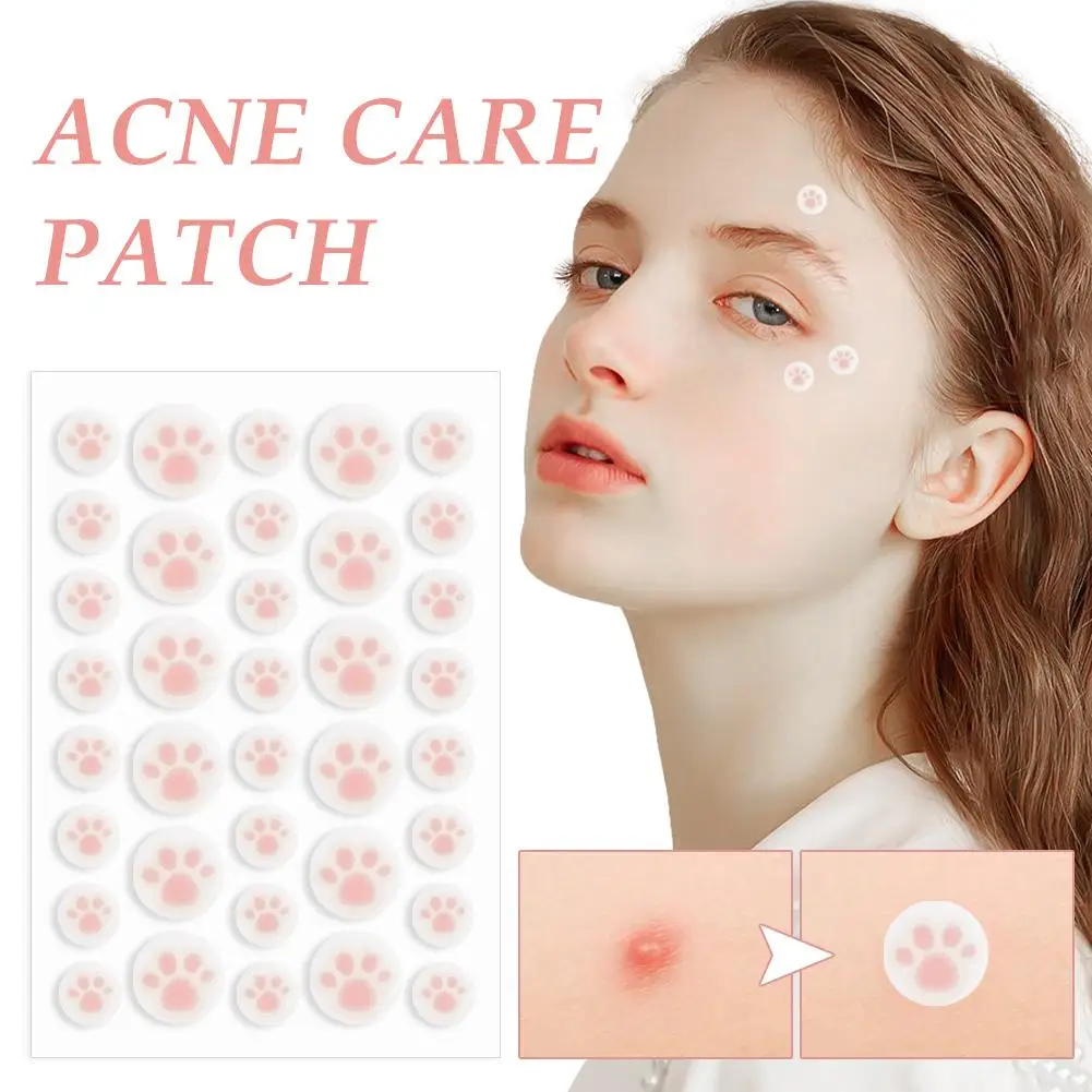 Acne Pimple Patches,36 Counts Daytime Zit Covers,Absorb Excess Oil & Protect from Picking,Pickel patches, Korean Skin Care Style