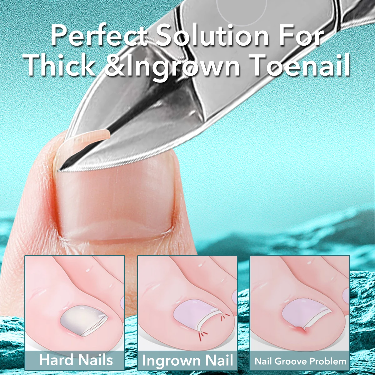 1 個厚い足の爪トリマークリッパーステンレス鋼プロフェッショナル爪周囲炎陥入爪カッターマニキュアフットケアペディキュアツール