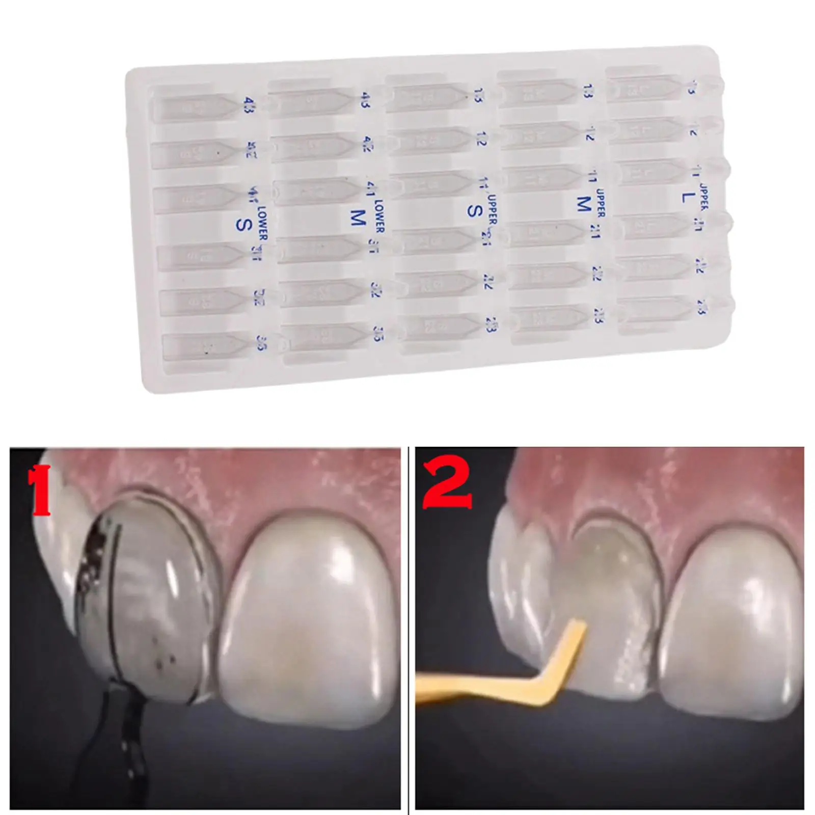 30x Beauty Veneers Food Grade Plastic Fast Quick Anterior Front