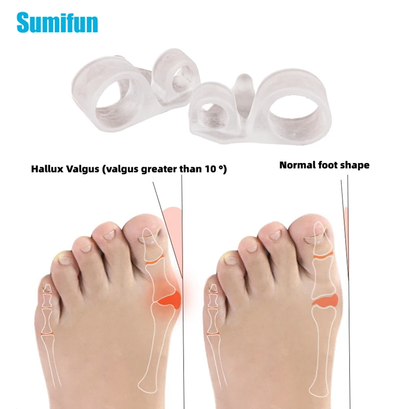 2Pcs/Pair Two-Hole Silicone Toe Separator Bunion Hallux Valgus Correction Toes Overlap Orthopedics Foot Clamp Protector Pad