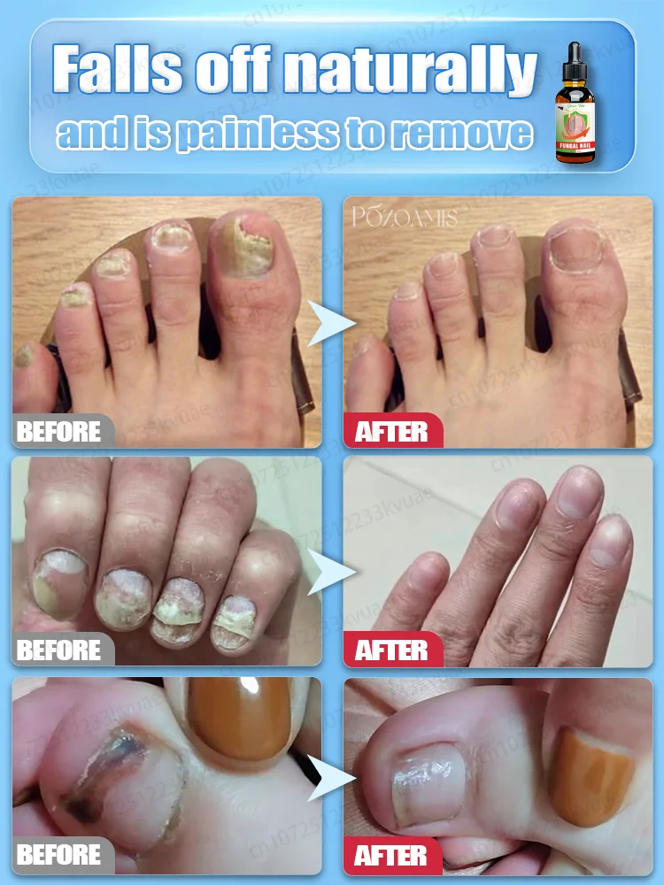 7일 만에 완고한 곰팡이 제거