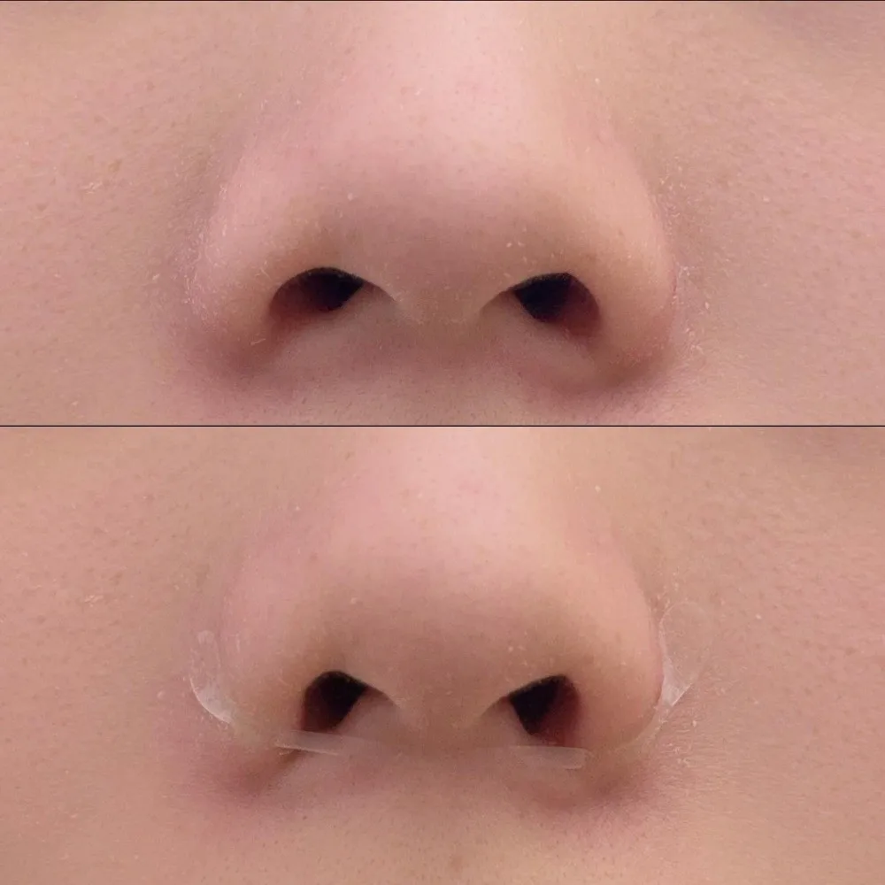 100Pcs Invisible Nose Shrink Patch Breathable Transparent Nose Shaper Strips Thin Slimming Nasal Wing Stickers
