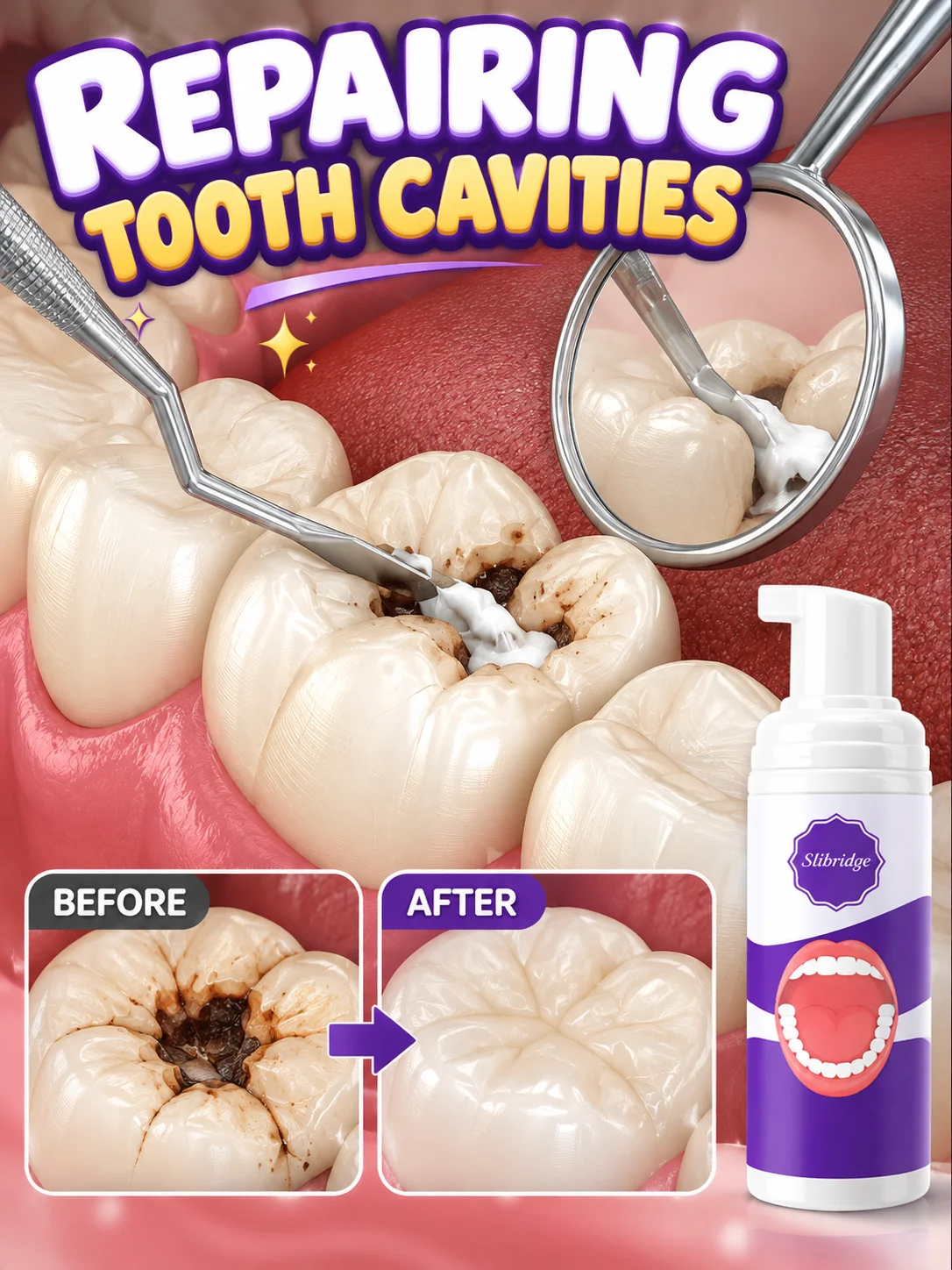 From Worrying About Tiny Dark Spots on Your Teeth to Giving Every Bite a Little Extra Care with a Simple Daily Oral Care Mousse