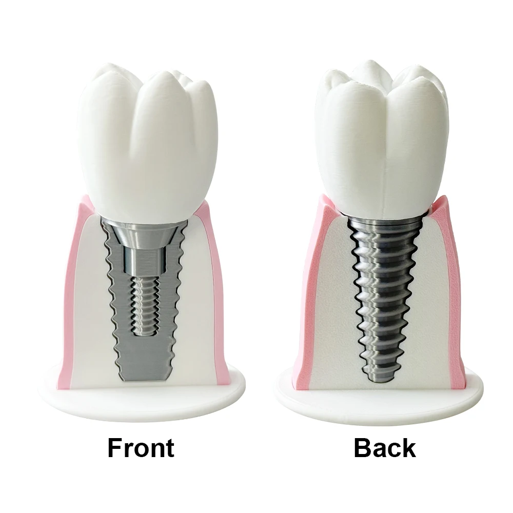 Thumbnail 3 - #2 Latest Dental Teaching Models Offers