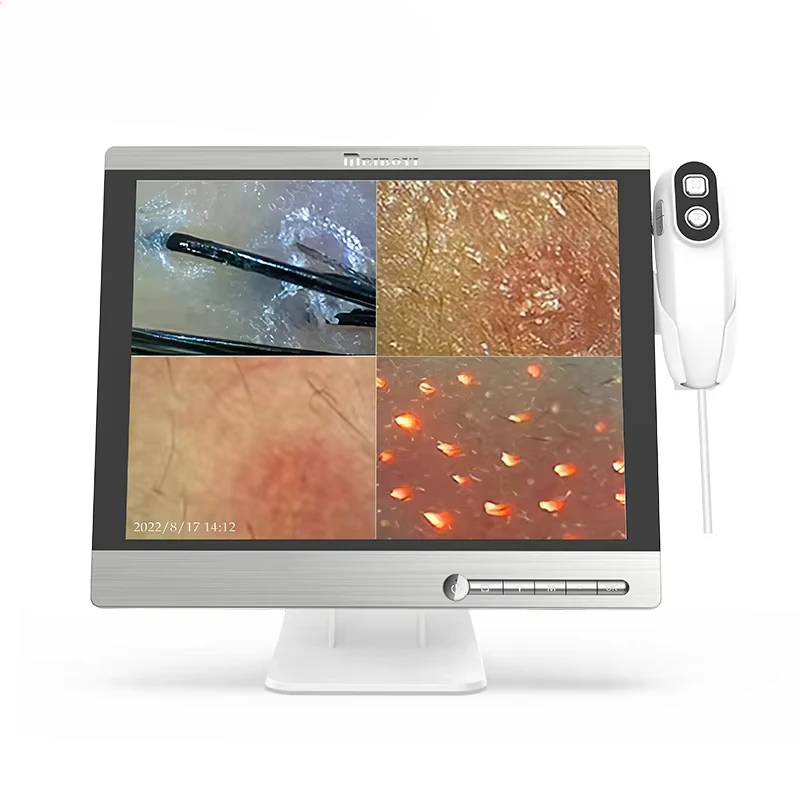 15 Inch Big Screen Scalp Detector HD Hair Analyzer Skin Analysis Device Scalp Camera Scalp Diagnosis Beauty Salons