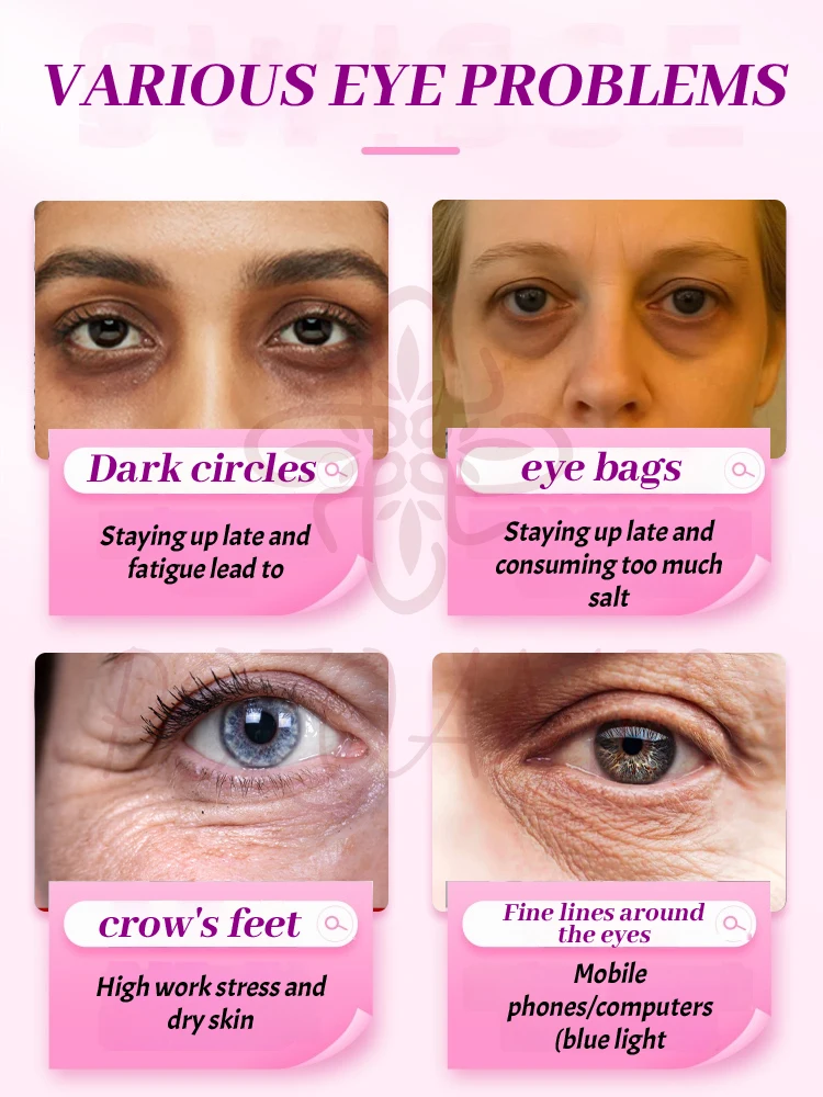 Nourishing Under Eye Cream, Hydrate Dry Eye Area, Soften Fine Dry Lines, Optimize Dark Circles, Eye Puffiness and Loose Skin Appearance for Women Daily Skincare