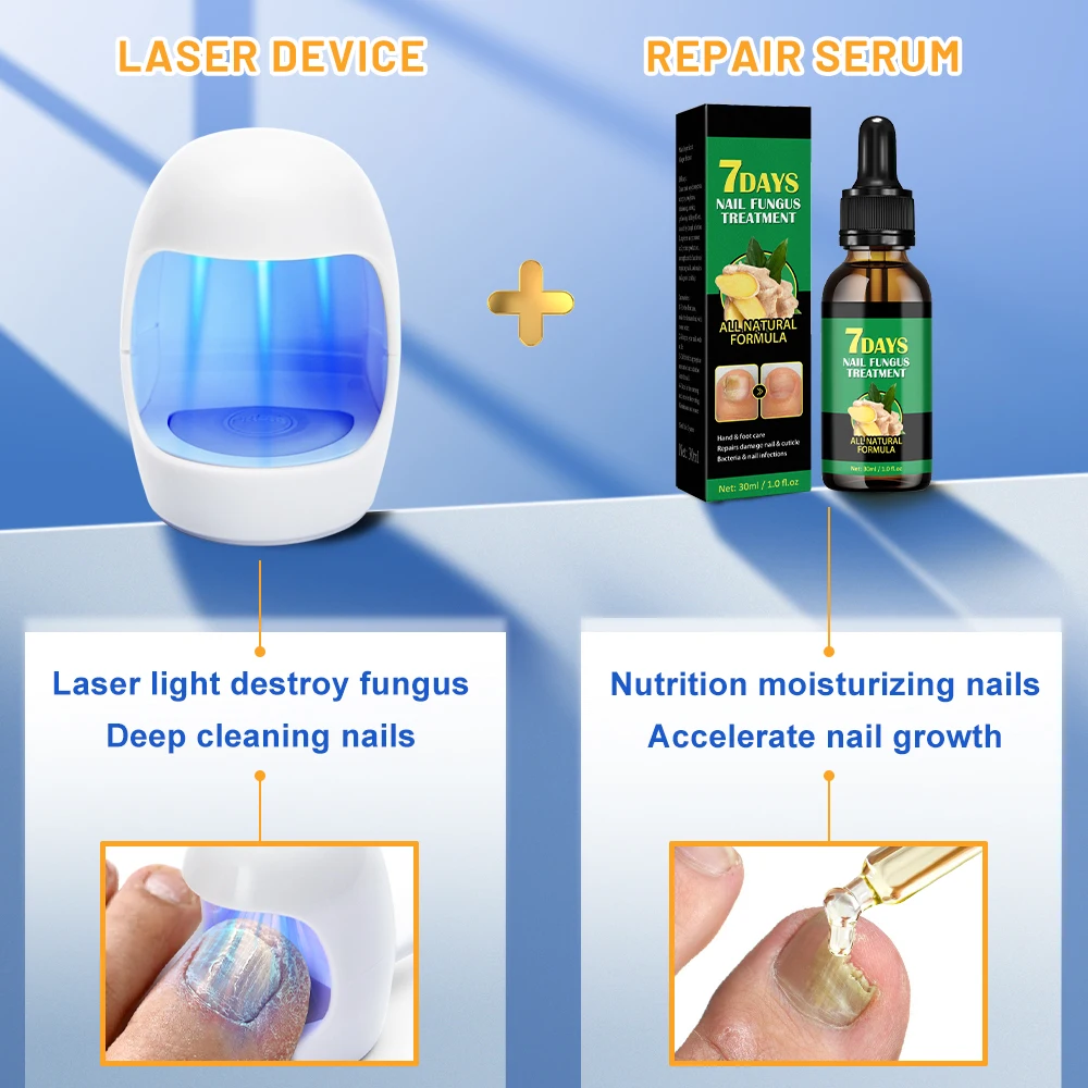 

Fungus NailLaser Treatment Device Repair Toenail Fingernail Essential Oil Onychomycosis Treat Toenail Nail Fungal Treatment