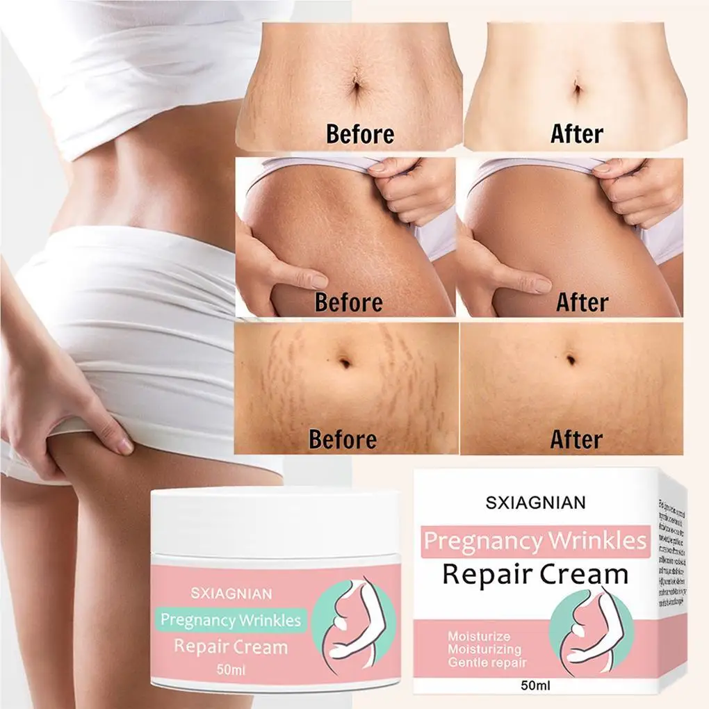 Women Stretch Mark Cream Pregnancy Wrinkles Comfortable Beauty Tools Safe Scars Remover Home Waist Body Care Supplies