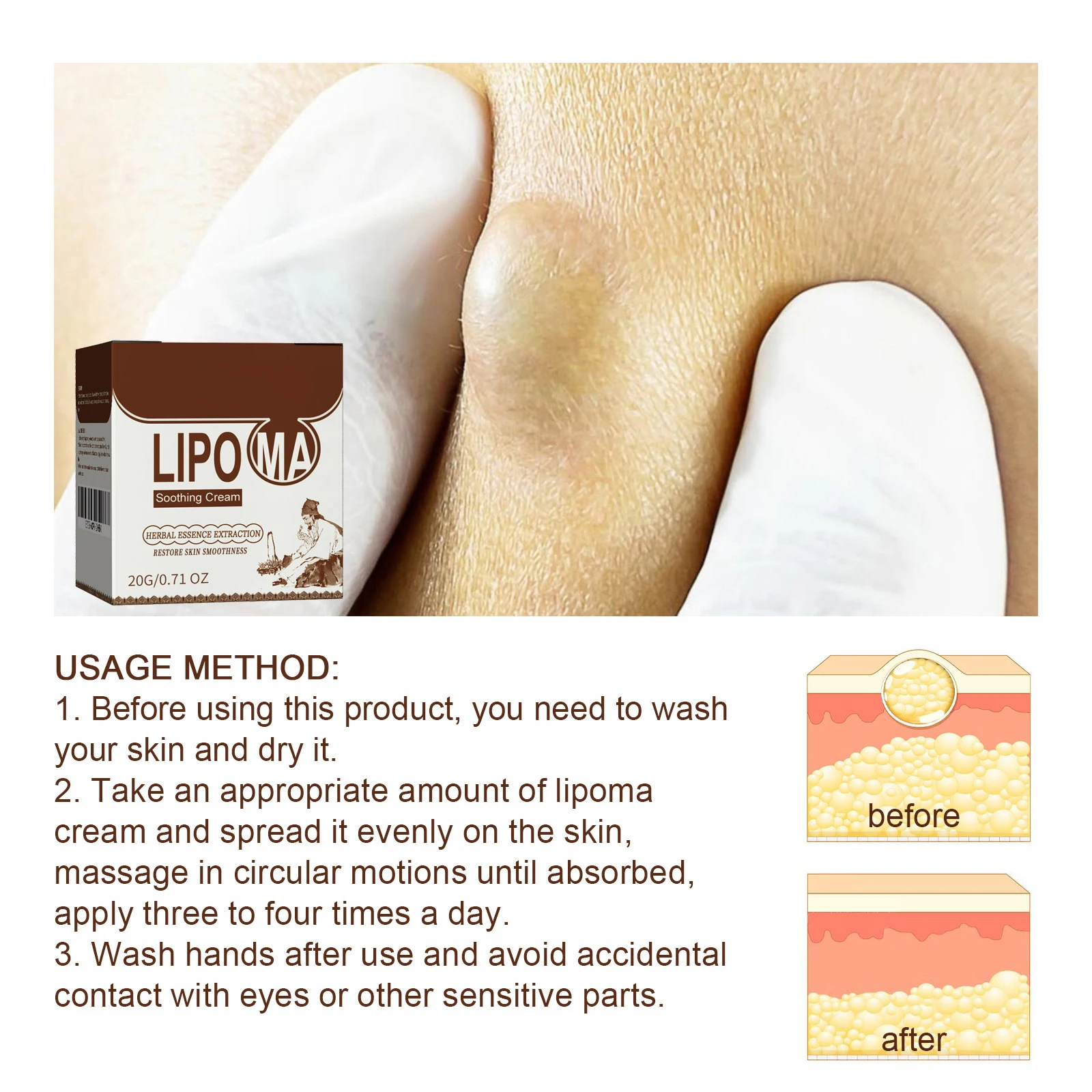 Soothing Cream Subcutaneous Lumps Remover Cellulite Removal Cream Relieve Body Fat Subcutaneous Hard Lump Body Health Care Cream