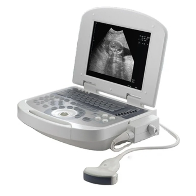 

Superior Quality High Accuracy Wireless Hand Held Portable Veterinary Ultrasound