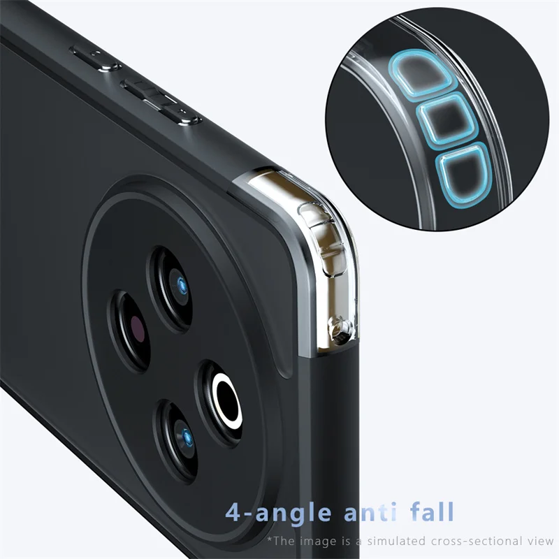 Para vivo Y300 Pro Funda vivo Y300 Pro Funda de lujo mate PC + TPU Protector a prueba de golpes Funda trasera de teléfono vivo Y300 Pro