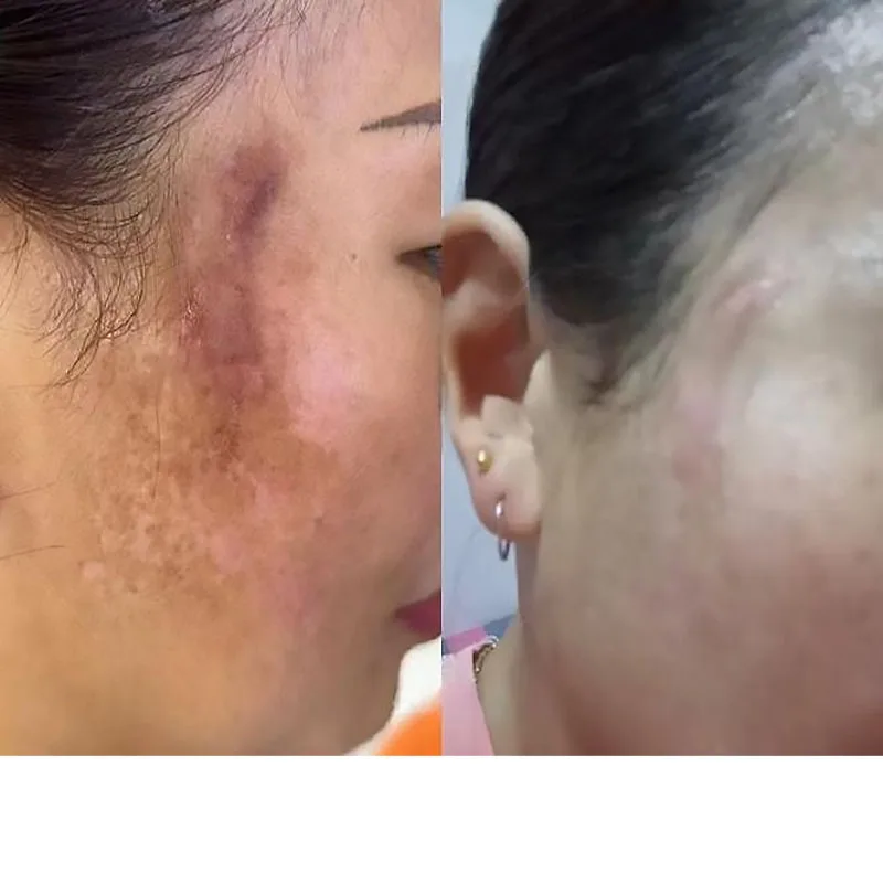 

Vitamin C Whitening Freckles Face Serum Fast Remove Dark Spots Fade Melanin Anti-Wrinkle Moisturizing Brighten Repair Skin Care