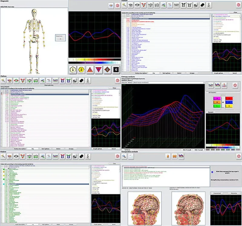 Hunter 4025 Bioresonance NLS Meta-pathia NonLinear Etalons System Health Analyzer Therapy Machine Body Scan Device Auto Therapy