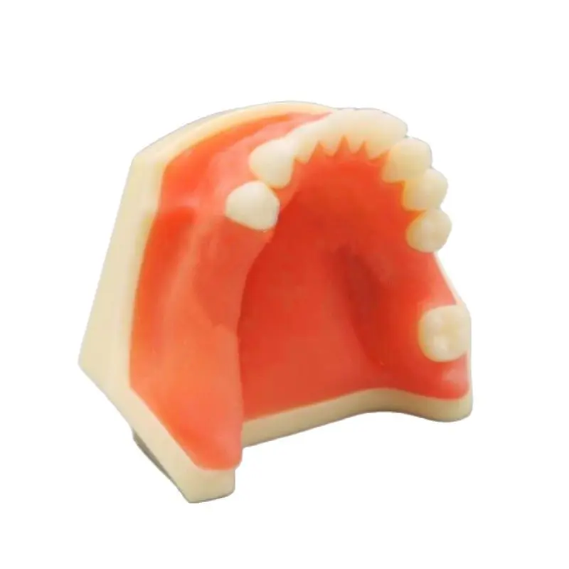Dental Teaching Models Mandibular Implant Education Practice Soft Gum Mold Dentistry Demonstration Students Training Tools M2006